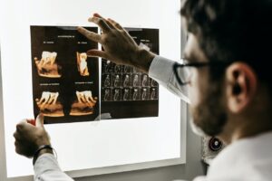 Dentist examining x-ray photo
